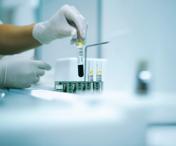 A test titkos nyelve: mit mesél egy csepp vér a vérvétel során