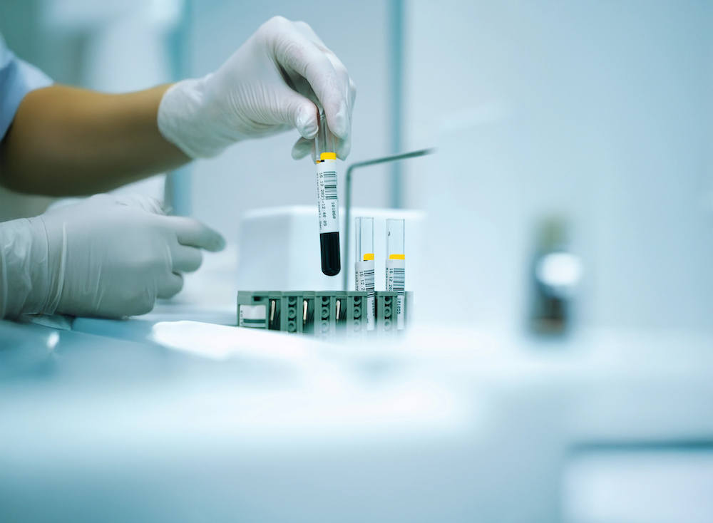 A test titkos nyelve: mit mesél egy csepp vér a vérvétel során